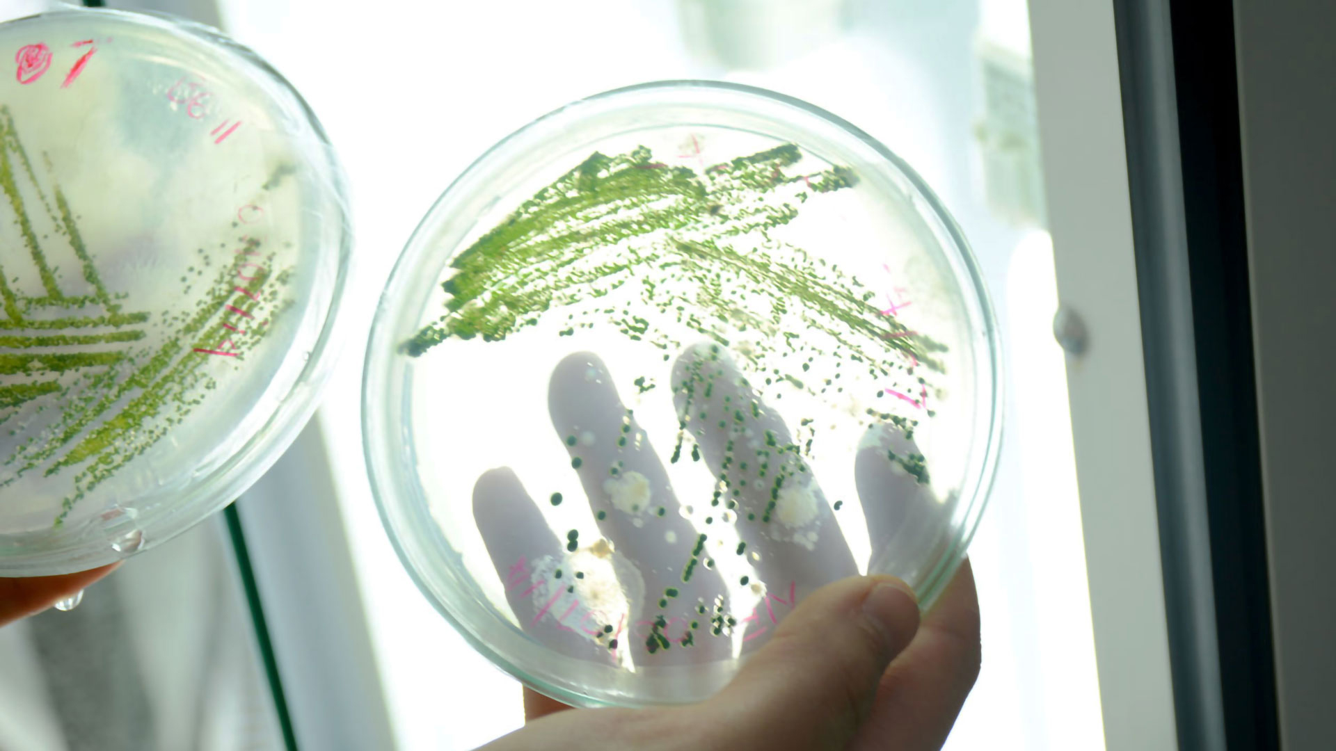 antimicrobial protection