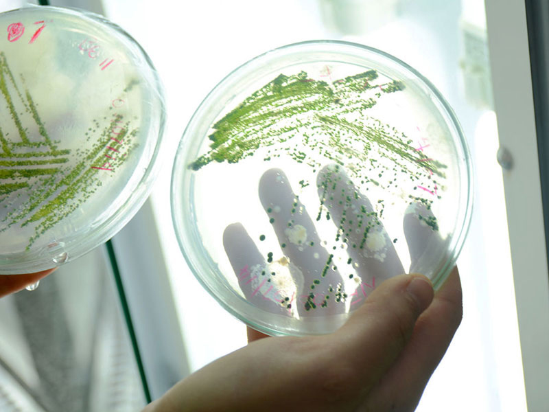 Antimicrobial protection